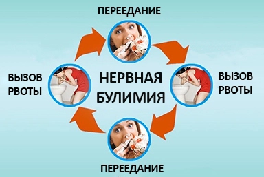 Лечение булимии в Ивановской